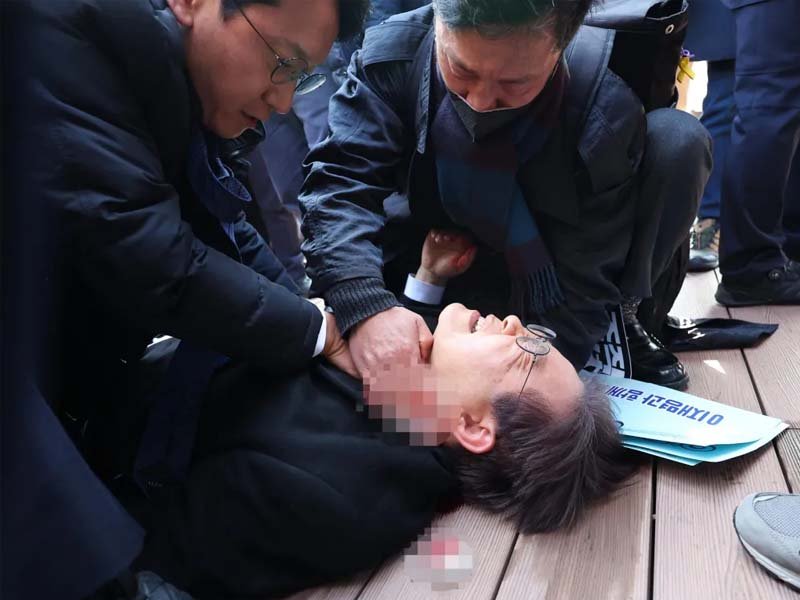 Lee Jae-myung, líder de la oposición en Corea del Sur, en recuperación tras recibir puñalada